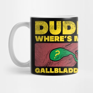 Dude Where's My Gallbladder Mug